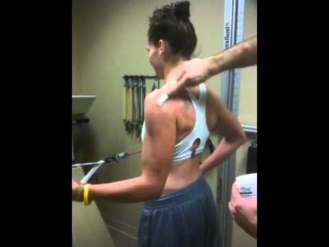 how to cure shoulder impingement