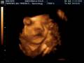 babyboy paredes