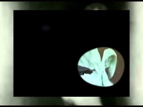 See video