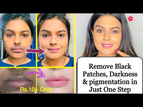 REMOVE DARKNESS AROUND MOUTH AT HOME || Remove With 1 Step Mouth Dark patches & Pigmentation