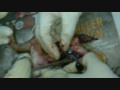 User Thumb 3