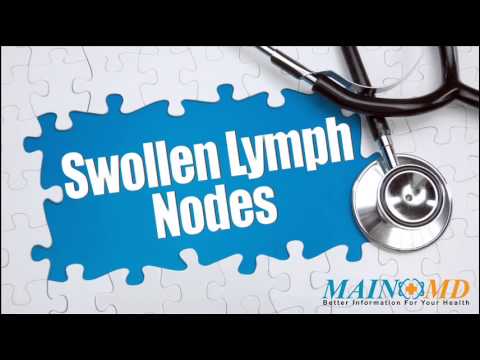 how to relieve lymph node swelling