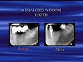 Elite Endodontics