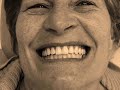CARGA IMEDIATA, 12 ELEMENTOS EM PORCELANA COM GENGIVA, PARAFUSADA, ANTES & DEPOIS, CD JUERGEN SEBASTIAN, PRÓTESE DENTÁRIA, EDSON RODRIGO TREVISANI, LABORATÓRIO TREVISANI