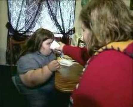 Das dickste Kind der Welt - Fattest Child in the world