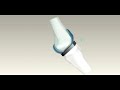 Prothesis Prothesis