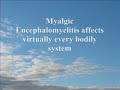 Some facts about Myalgic Encephalomyelitis (and me)