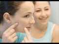 Acne facts Acne facts