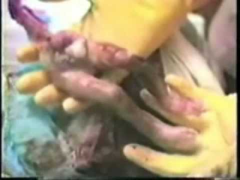 NO AL ABORTO