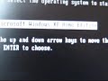 xp hack