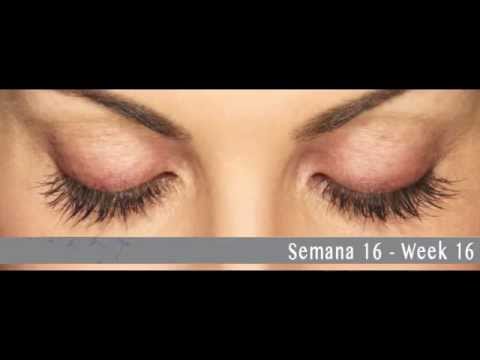 how to administer xalatan eye drops
