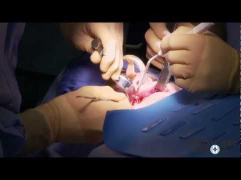 See video