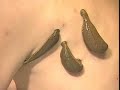Master Ee leech remedy treatment effect,merry christmas,fun