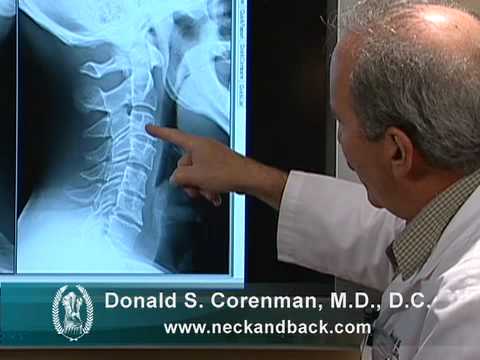 how to read x rays