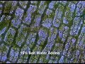 Plasmolysis in Elodea