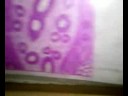 Epithelium Epithelium