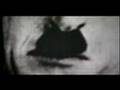Brain Damage affecting Perception in multiple ways -part 1/2