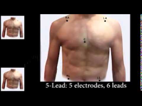 how to measure the p-r interval