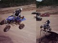 quads