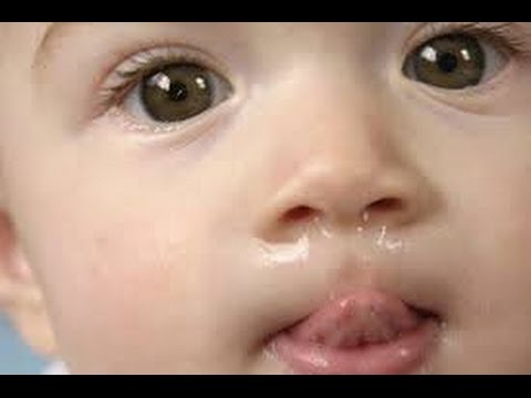 how to relieve runny nose in toddlers