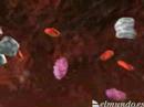 Metastasis Cancer