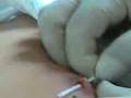 videos de colocando pircing mamilo.3gp