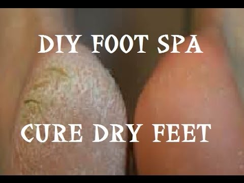 how to cure very dry feet