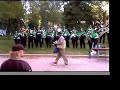 complex-lobotomy-live.html