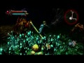 Click here to watch this video Kingdoms of Amalur : Reckoning - Ep. #3 - Spiders Is Creepy
