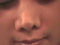 Thumbnail #1