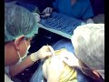 removal of malignant bukol - Abz