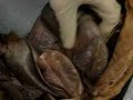 Uterine horns after preganancy