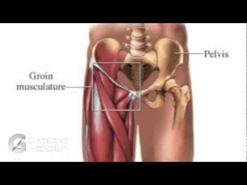 how to cure groin pull