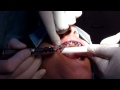 Click here to watch this video scan2guide Dr. Musaev Alexander 005.MOV