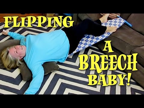 how to turn a breech baby nz
