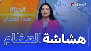 الحياة هذا الصباح: هشاشة العظام..الأعراض، الأسباب و العلاج