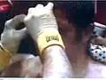 pither manfredo vs alfonso gomez