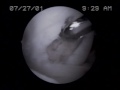 Video 03