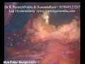 Laparoscopy Hysterectomy TLH LAVH Video (Lap Uterus Removal