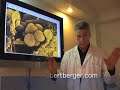 Stage I Breast Cancer Cells