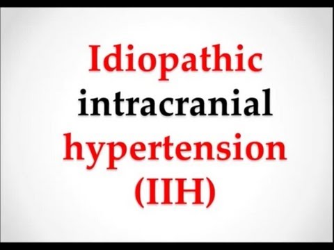 how to treat idiopathic intracranial hypertension