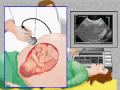 Ultrasound machines