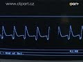 Heart Heart