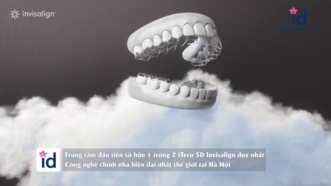 Invisalign Khay chỉnh nha