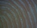 My Fingertip at 150x Magnification My Fingertip at 150x Magnification