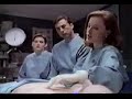 X-Files Deleted Scene \