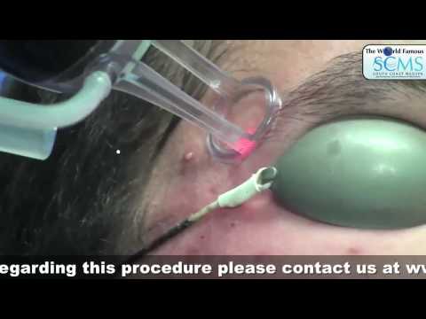 how to cure scars on face