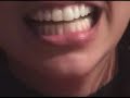 Radikaos - Jet Ski