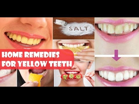 how to whiten teeth with sunflower oil