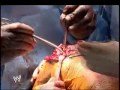 WWE Batista in Emergency Room.mp4 WWE Batista in Emergency Room.mp4